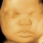 Traditional 3D Image- 30 weeks
